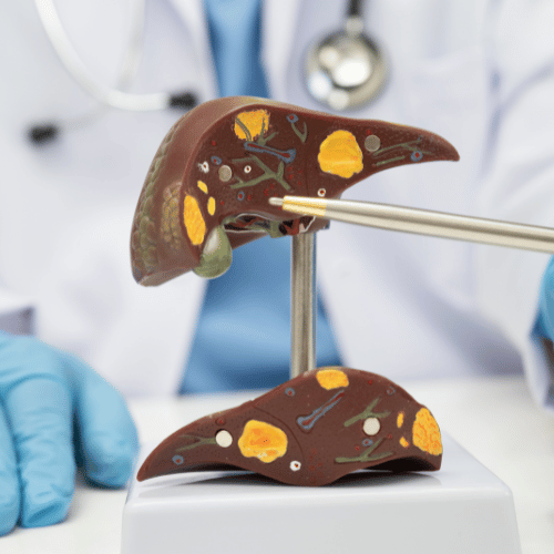 Liver disease treatment