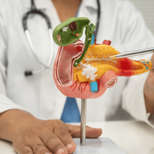 Pancreatitis treatment